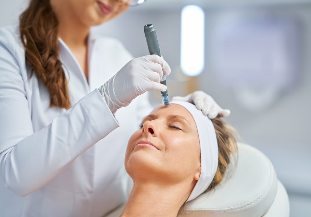 Microneedling Poole