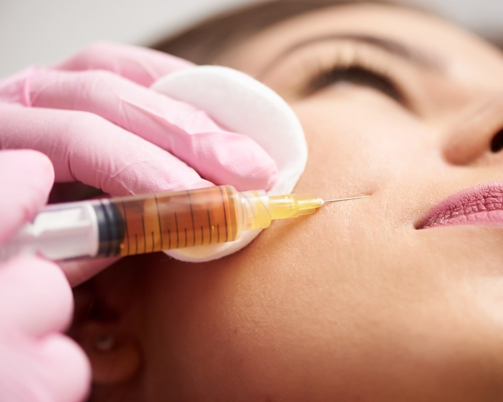 lemon bottle skin boosters Poole